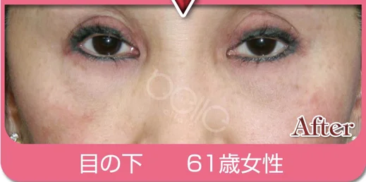 施術例３の施術後
