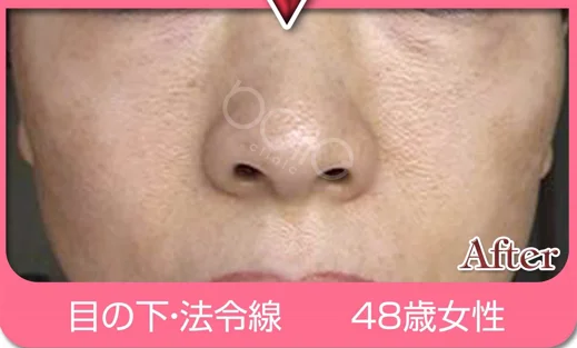 施術例６の施術後