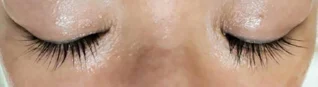 施術の施術例:まつ毛育毛(施術後)