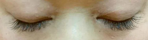 目元のオシャレ感アップの施術後