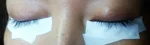美しさは目元からの施術前