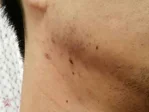 びっくりするほど美男子になっていますよの施術前