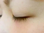 自然なボリュームをの施術前