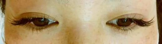 大人げなクール&セクシーな目元にの施術後